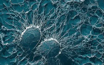 Lecture series on the TDM of antibiotics