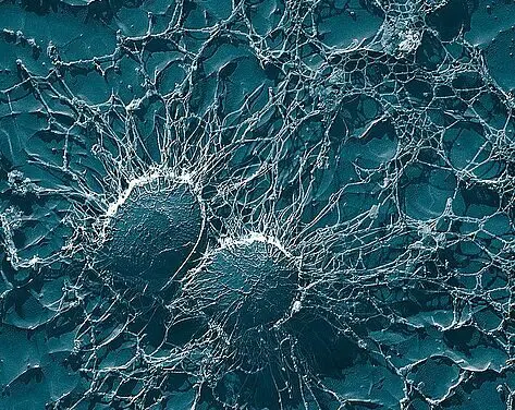 Lecture series on the TDM of antibiotics