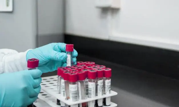 Interlaboratory tests: “Failure to comply with the requirements could not only result in civil claims for damages in the event of damage, but could also be relevant under criminal law”