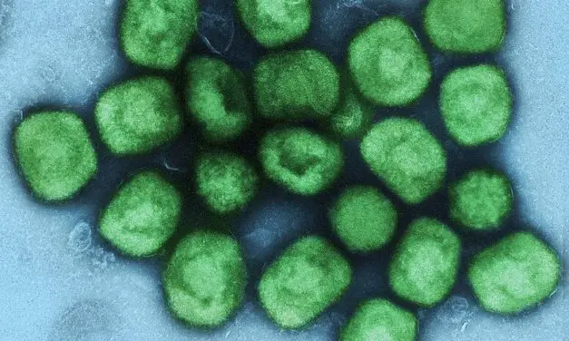 action medeor supports Sierra Leone in the fight against mpox