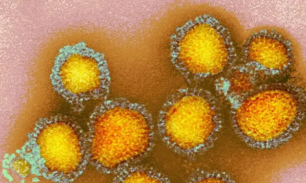 Changed CDC communication on vaccinations and autism reduces vaccine willingness and trust