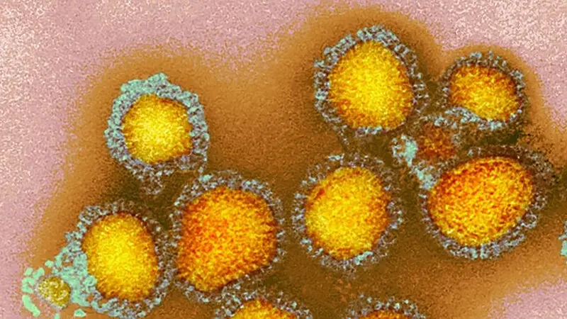 Changed CDC communication on vaccinations and autism reduces vaccine willingness and trust