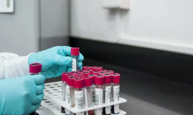 New biomarkers for severe chlamydia infections identified