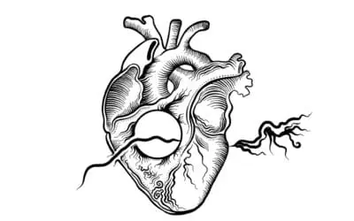 AI improves risk assessment in the most common form of heart attack