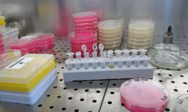 Rare case of gelatinous urine diagnosed in urinary tract infection