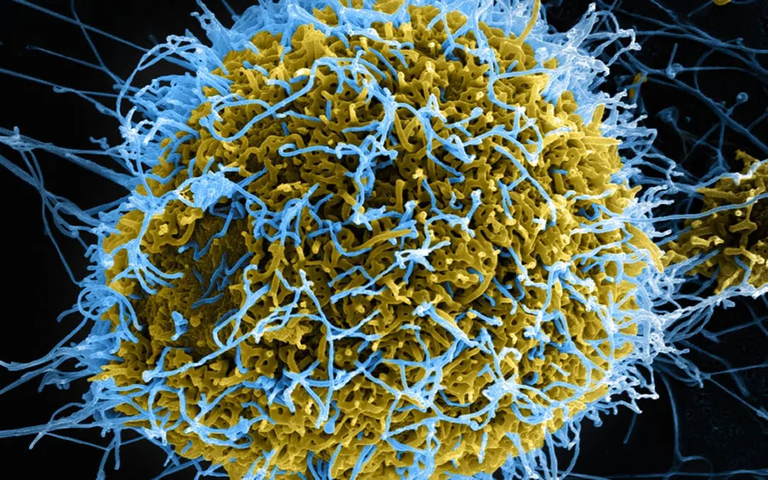Ebola outbreak in Congo declared a global health emergency