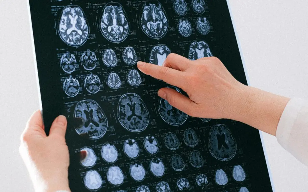 BMFTR: New funding guideline to reduce the gender data gap in clinical research