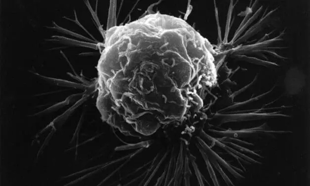 Breast cancer: 44th Annual Congress of the German Society of Senology in Stuttgart