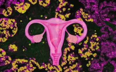 Potential breakthrough in the treatment of ovarian cancer