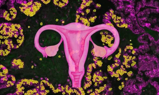 Potential breakthrough in the treatment of ovarian cancer