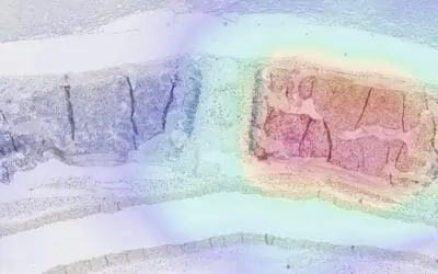 TUM researchers develop method for tracking manipulated immune cells