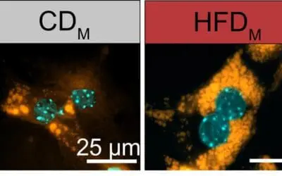Maternal obesity reprograms the metabolism of the offspring in the womb