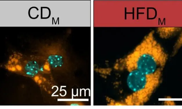 Maternal obesity reprograms the metabolism of the offspring in the womb