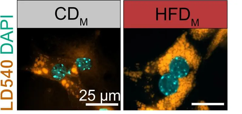 Maternal obesity reprograms the metabolism of the offspring in the womb
