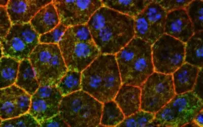 Cholesterol metabolism offers new approach against macular degeneration