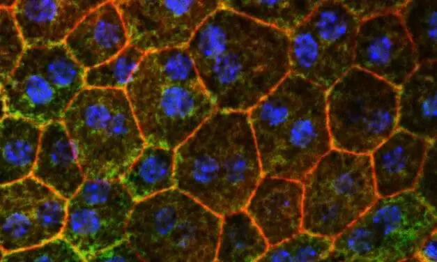 Cholesterol metabolism offers new approach against macular degeneration