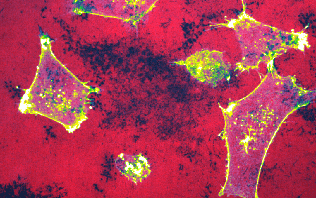 MiROM technology enables rapid evaluation of cancer treatments without markers