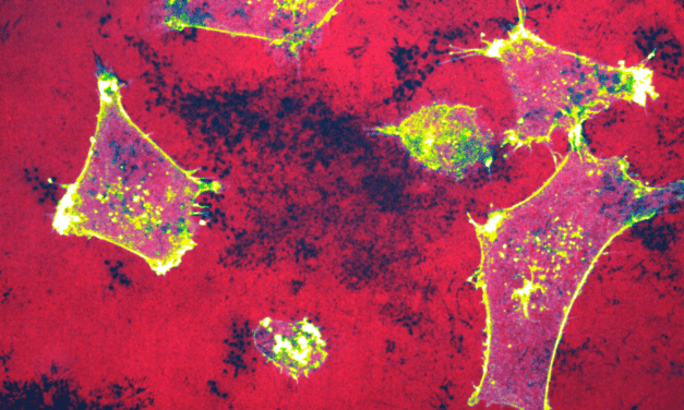 MiROM technology enables rapid evaluation of cancer treatments without markers