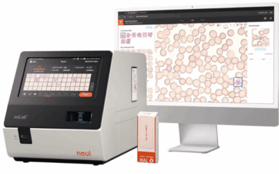 A new approach to malaria diagnostics: fast, precise, sustainable