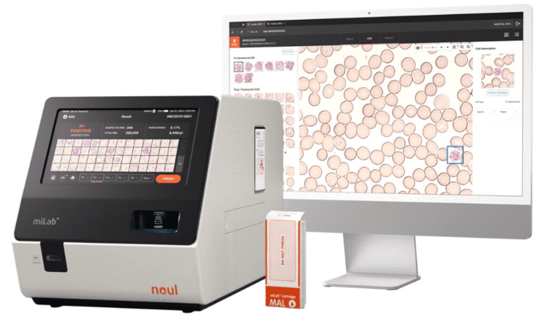 A new approach to malaria diagnostics: fast, precise, sustainable