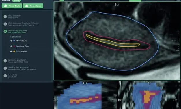 Diagnostics: RACOON THREAD revolutionizes early detection of adenomyosis