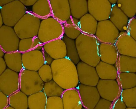 Abdominal fat endangers blood vessels: new findings from Göttingen