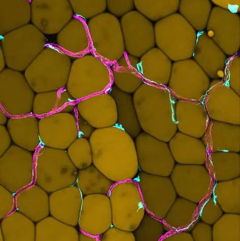 Abdominal fat endangers blood vessels: new findings from Göttingen