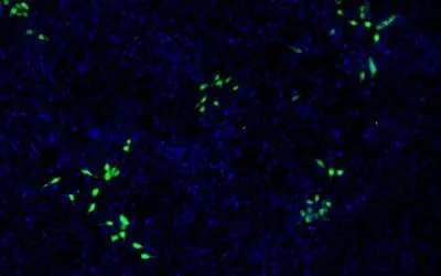 Hepatitis E virus also affects kidney cells: New findings complicate therapy