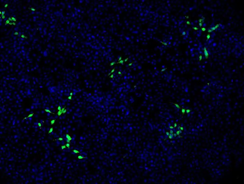 Hepatitis E virus also affects kidney cells: New findings complicate therapy