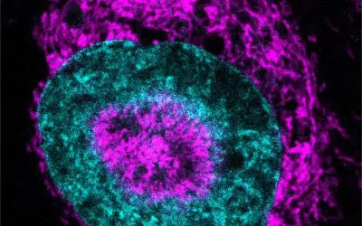 Cancer cells under pressure use energy boost for DNA repair