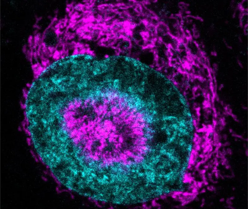 Cancer cells under pressure use energy boost for DNA repair