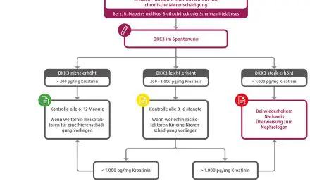 DKK3 in urine: early warning system for kidney damage