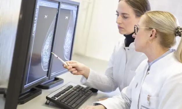 Mammography screening significantly increases detection of early breast cancer cases