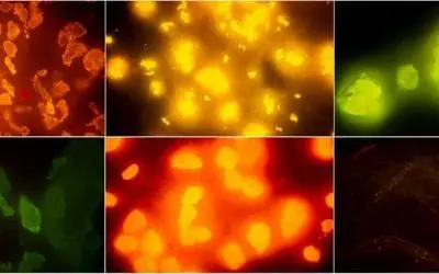 New methods for detecting microplastics in fish and seafood presented