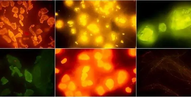 New methods for detecting microplastics in fish and seafood presented