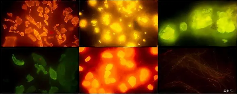 New methods for detecting microplastics in fish and seafood presented