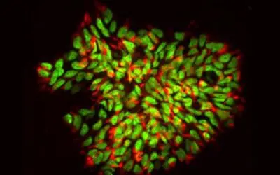 Multiple sclerosis: stem cells repair nerve damage