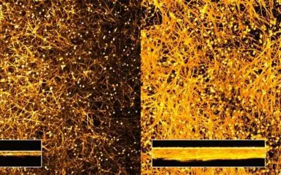 Sensation: Albumin triggers fungal virulence