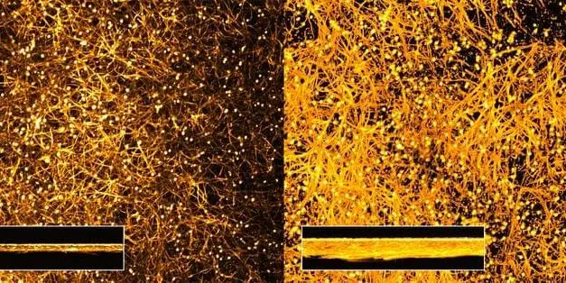 Sensation: Albumin triggers fungal virulence