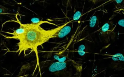 Groundbreaking: 400 nerve cell types produced from stem cells