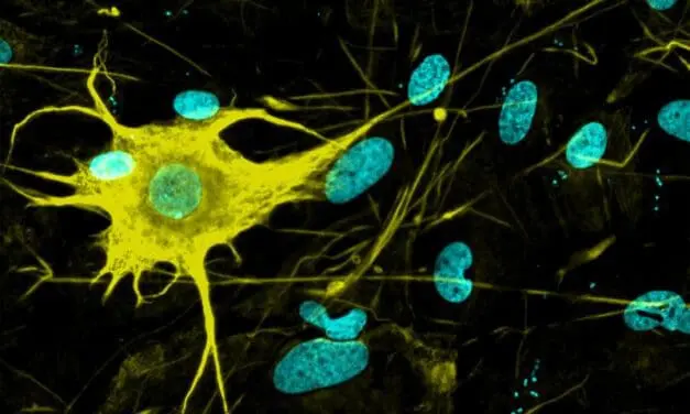 Groundbreaking: 400 nerve cell types produced from stem cells