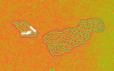 Pseudomonas aeruginosa: Helmholtz Center deciphers survival strategy of the hospital germ