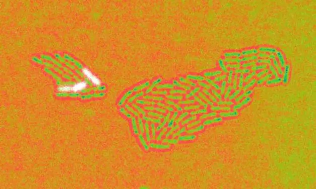 Pseudomonas aeruginosa: Helmholtz Center deciphers survival strategy of the hospital germ