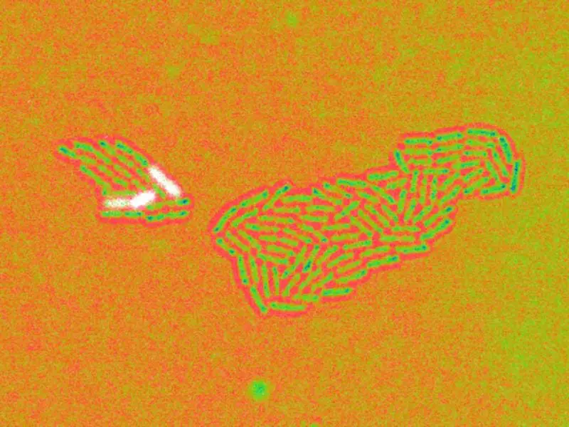 Pseudomonas aeruginosa: Helmholtz Center deciphers survival strategy of the hospital germ