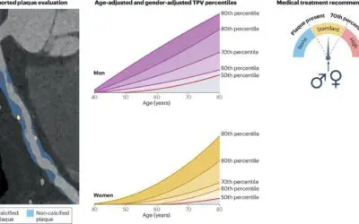 New recommendations for individualized treatment of hardening of the arteries through AI-assisted CT analysis