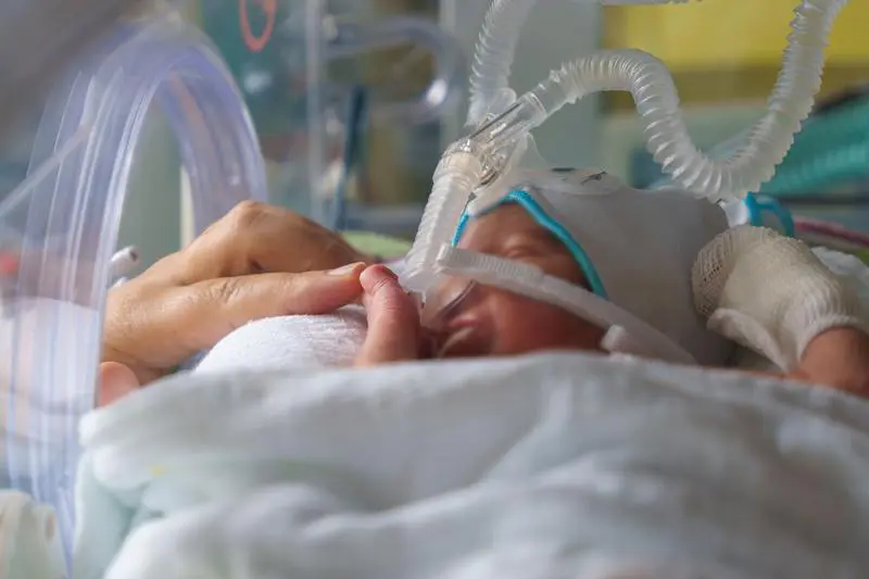 Minimum quantity regulation for premature babies: Federal states sue, experts warn of risks