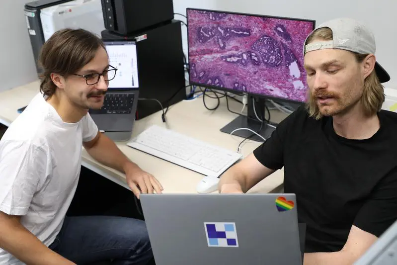 AI model revolutionizes the diagnosis of colorectal cancer