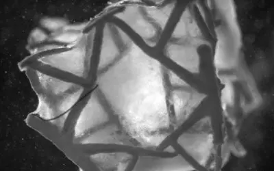 New heart patch from Zurich: Healing instead of mere closure