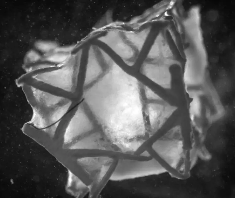 New heart patch from Zurich: Healing instead of mere closure