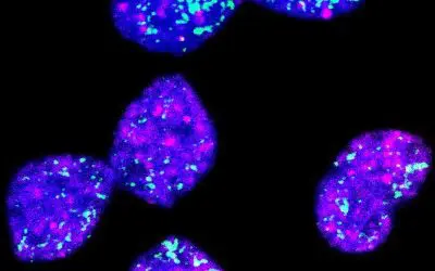 New therapeutic approach against aggressive neuroblastomas discovered